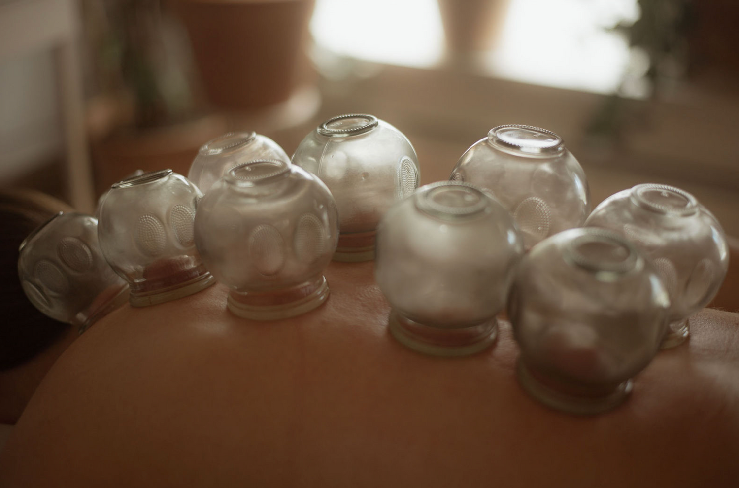 Experience the Healing Power of Cupping Therapy at Humanity Wellness in Yaletown, Vancouver